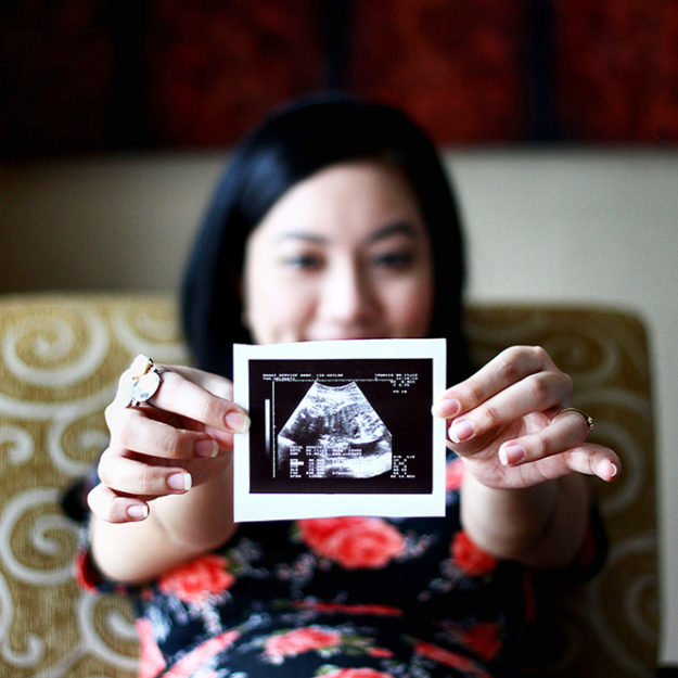 how_pregnancy_can_affect_oral_health_2017_665